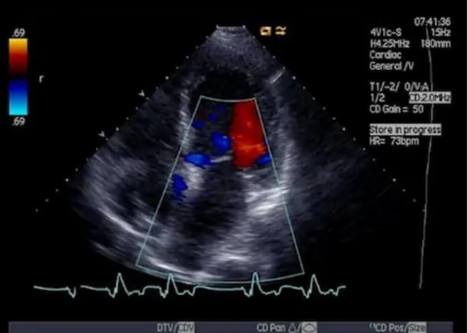 service-colour-doppler-sonography2.png
