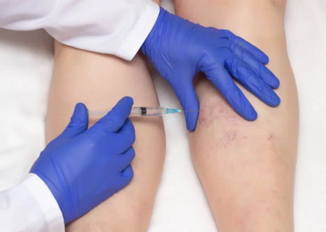 service-sclerotherapy2.png